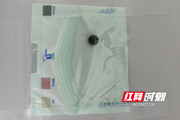 险！生锈铁球射入男子右眼远程门诊紧急求医(图2)