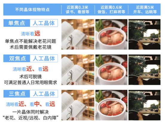 郑州爱尔眼科医院“屈光性白内障手术”已悄然成为老花白内障主流术式！(图4)