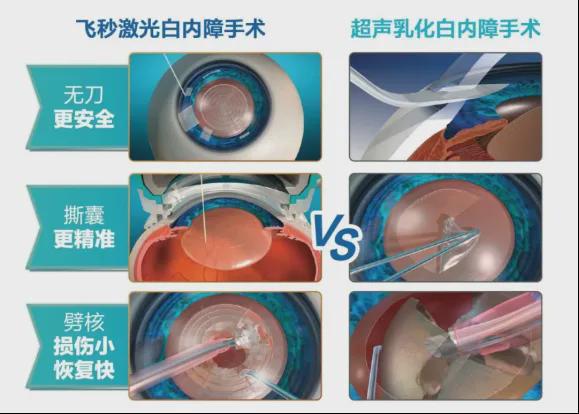 哪些患者适合选择飞秒激光辅助白内障手术？(图3)